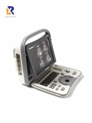 SonoScape A6 General Ultrasound System