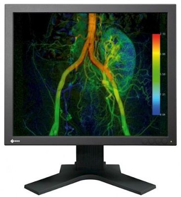High-Brightness EIZO EX190-S Diagnostic Display Monitor