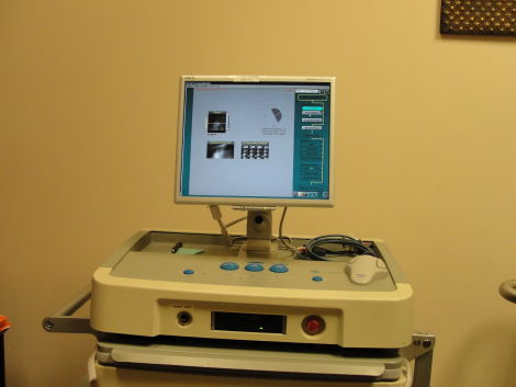 Digirad Cardius 1 Mobile Nuclear Gamma Camera
