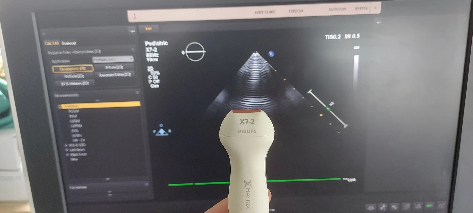 Philips X7-2 xMATRIX Sector Array Ultrasound Probe for EPIQ and Affiniti Systems – Live 3D Cardiac Transducer