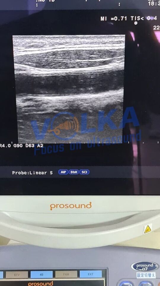 Aloka UST-5412 Ultrasound Transducer