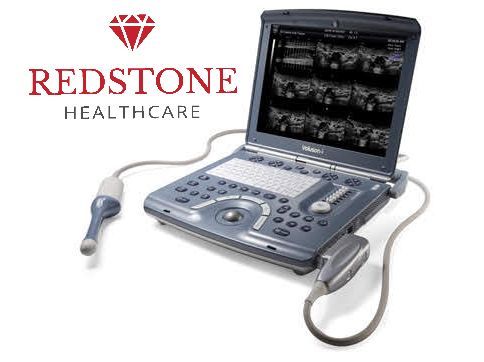 GE Voluson i Portable 4D OB/GYN Ultrasound System