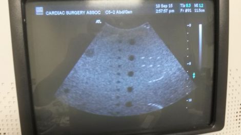 ATL C5-2 Curved Linear Ultrasound Transducer