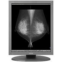 Diagnostic Review Display — Totoku ME551i2 Medical Monitor