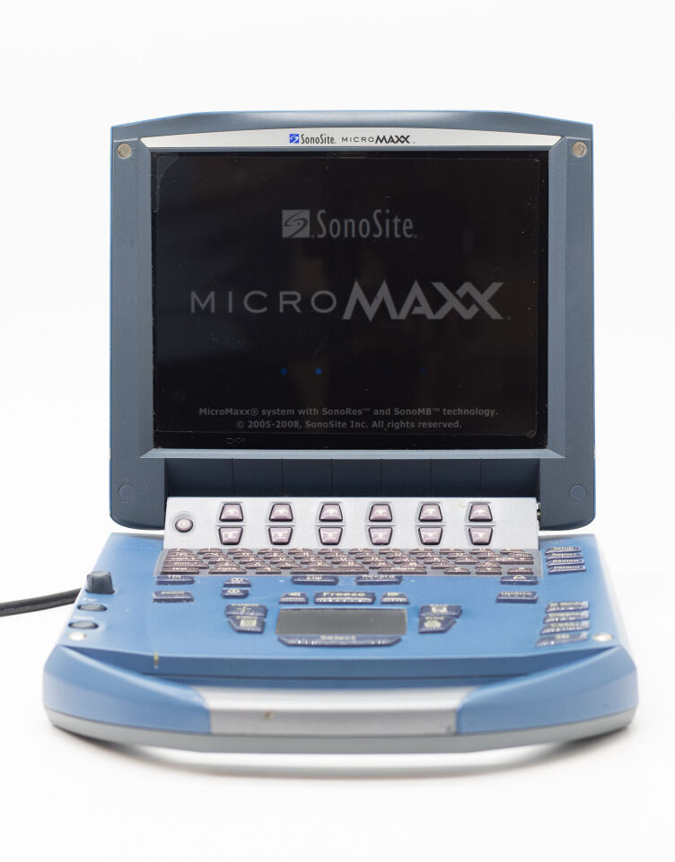 SonoSite MicroMaxx Portable Ultrasound System