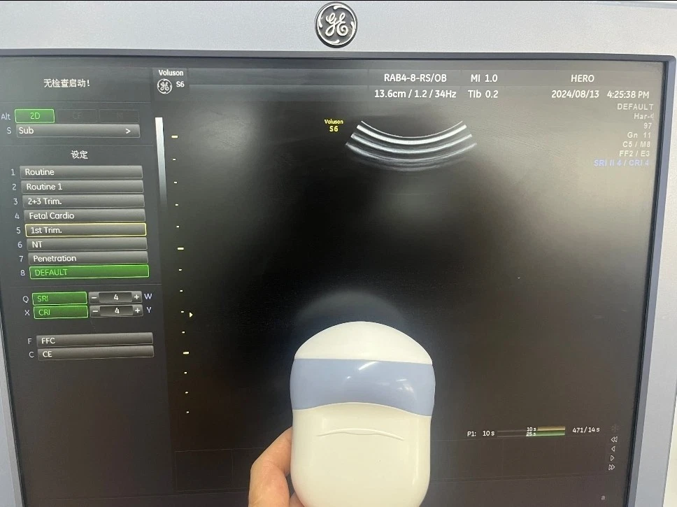 GE RAB4-8-RS 4D Volume Ultrasound Probe for Voluson E8, E10, S8 & Women's Health Imaging Systems – OB/GYN, Fetal and Abdominal Applications