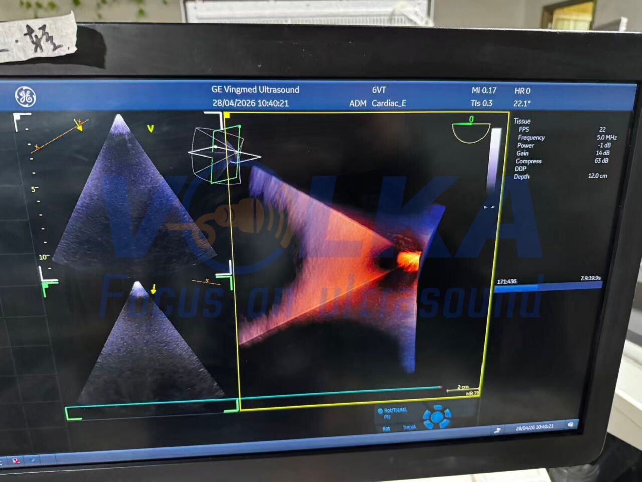 GE Healthcare 6VT-D 3D/4D TEE Cardiac Ultrasound Probe