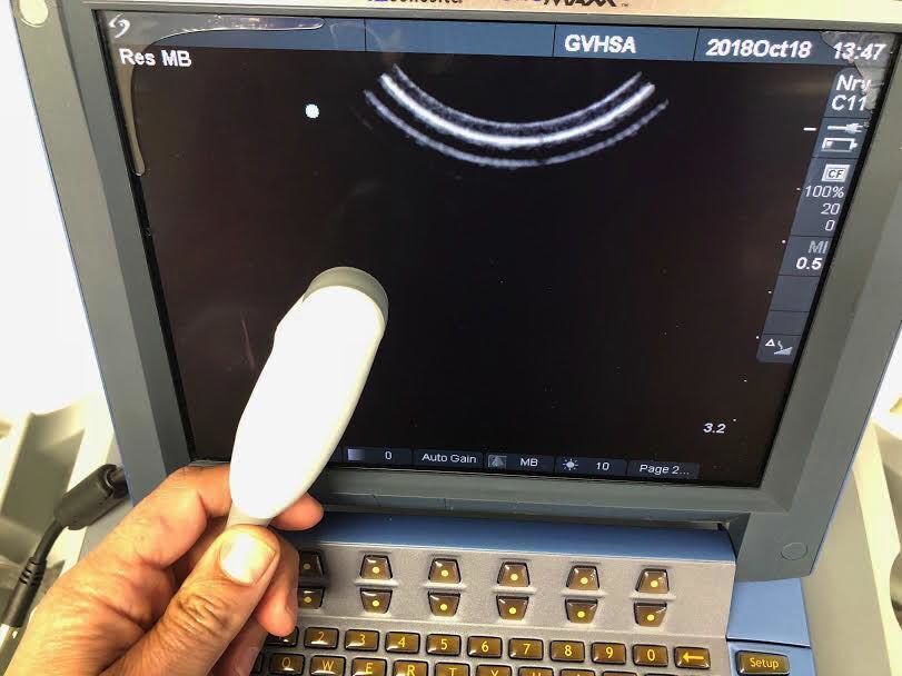 SonoSite C11E Curved Array Ultrasound Transducer for MicroMaxx System