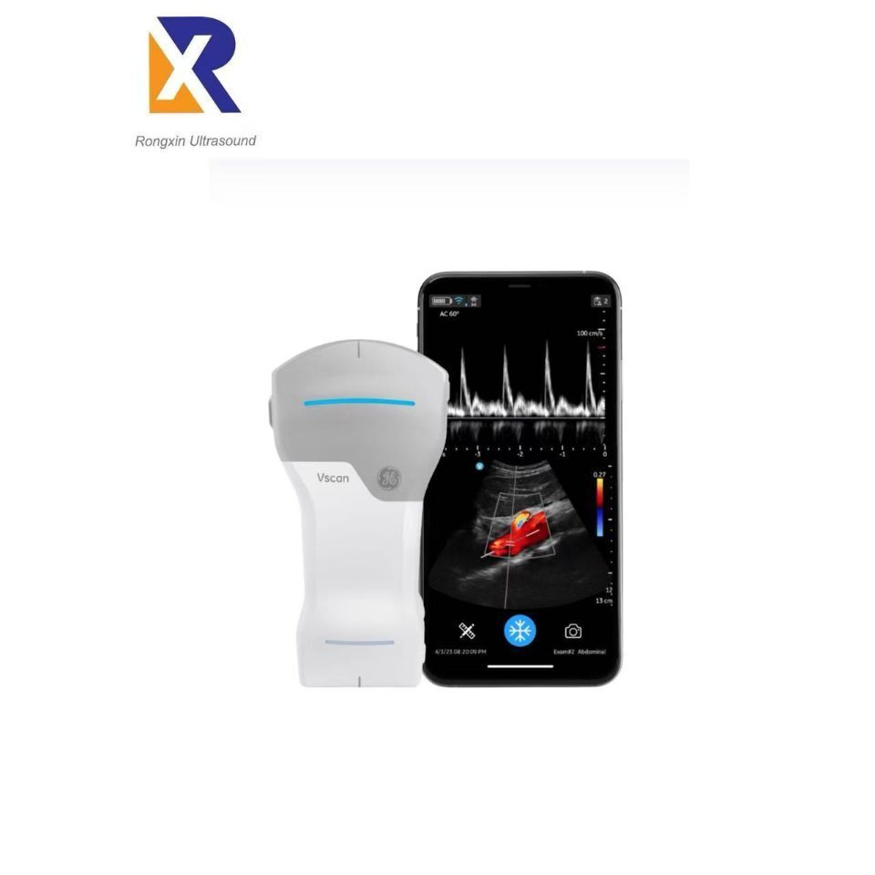 GE Vscan Air CL Wireless Handheld Ultrasound System