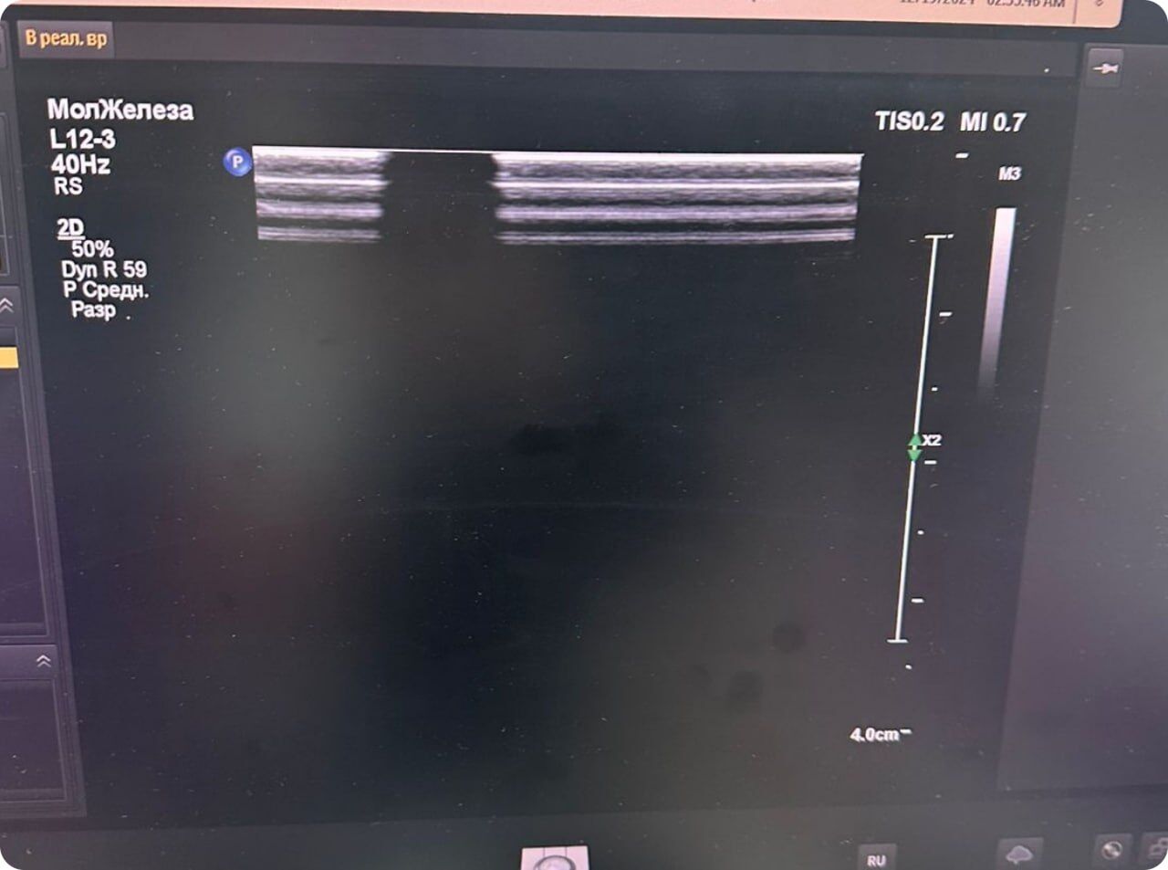 Philips Epiq 5 Ultrasound System Repair Service