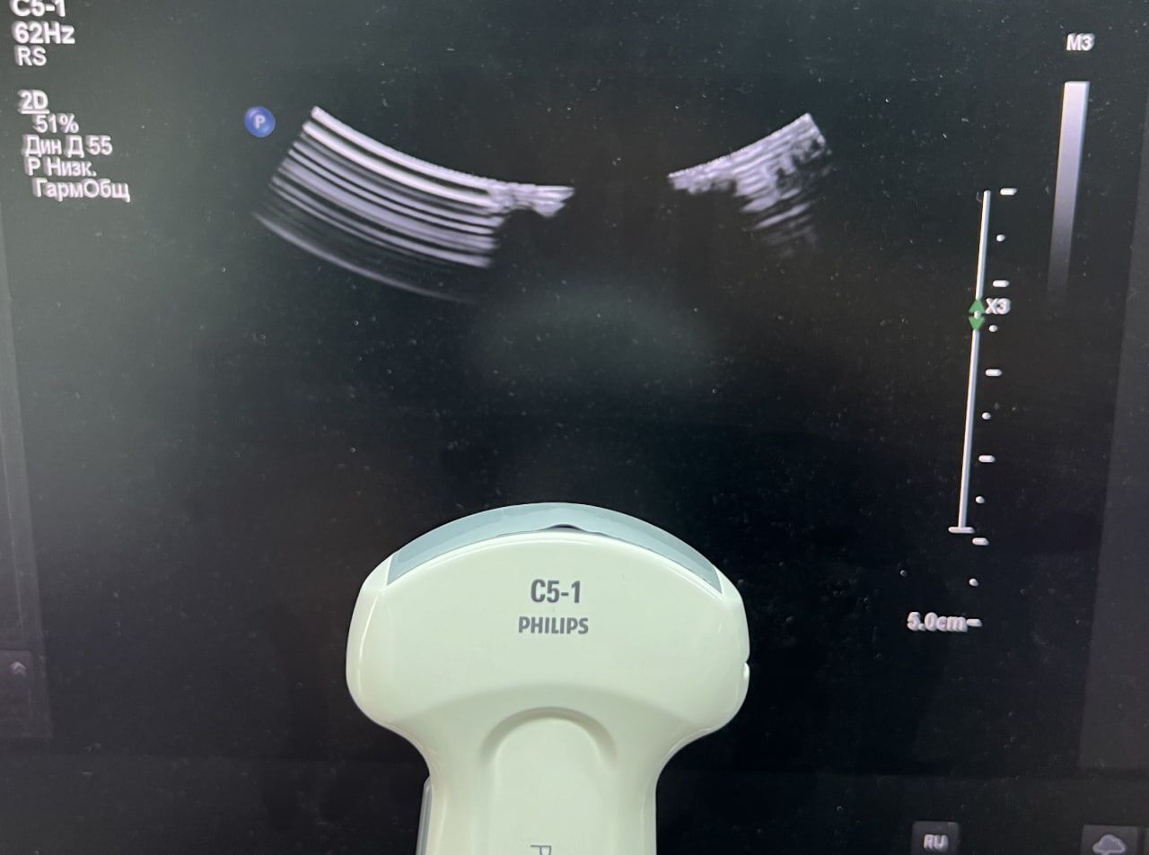 Philips C5-1 Convex Ultrasound Transducer