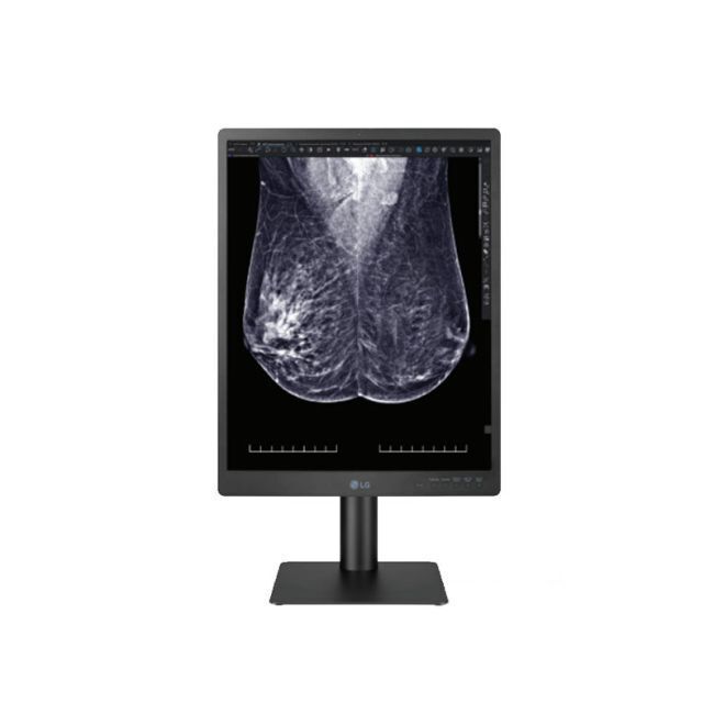LG 21HQ613D-B 5MP Diagnostic Radiology Monitor