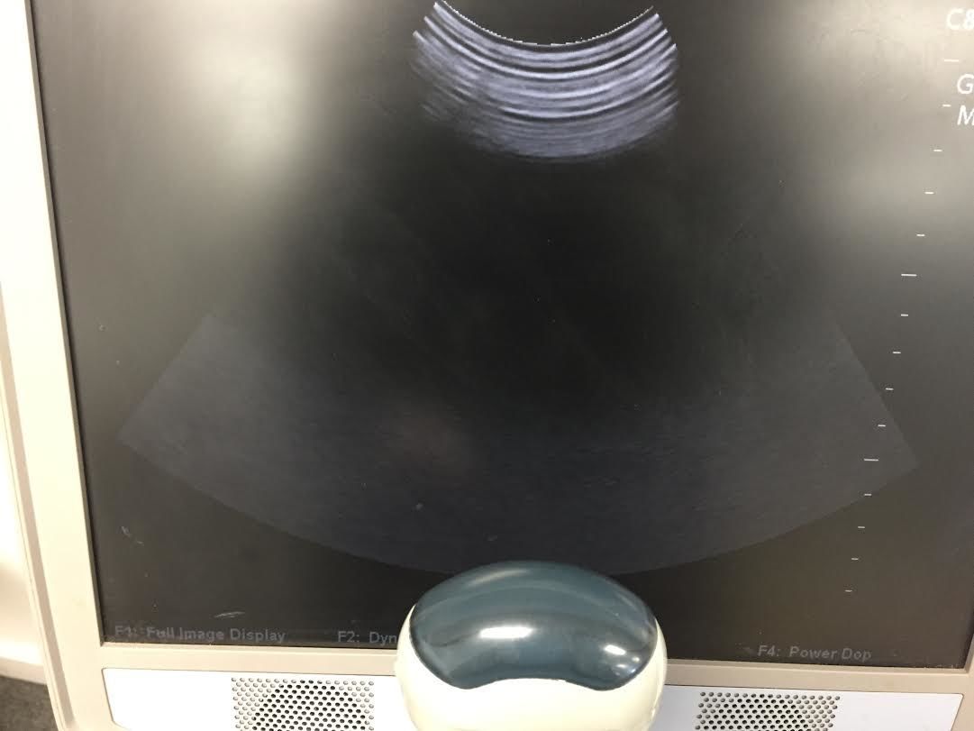 ZONARE C8-3 3D Convex Ultrasound Probe