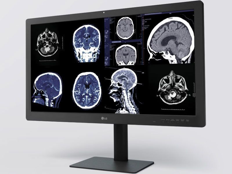 Diagnostic Radiology 8MP Monitor — LG 32HQ713D-B