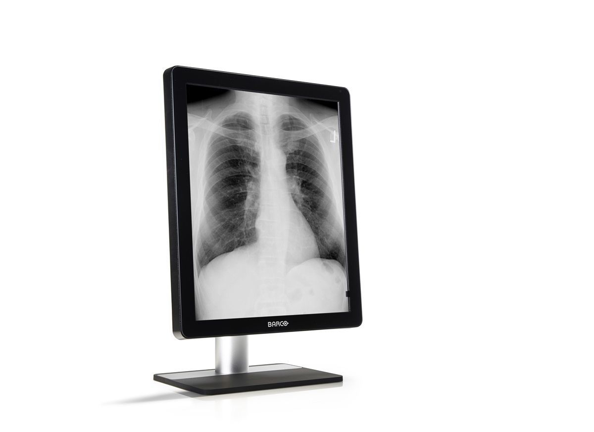 Barco MDCG-5221 Coronis 5MP LED Medical Display Monitor