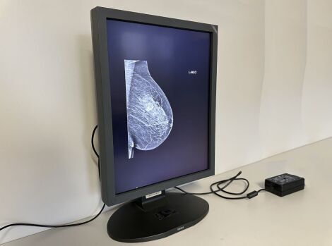 Totoku ME315L / MDL2105A Diagnostic Display Monitor