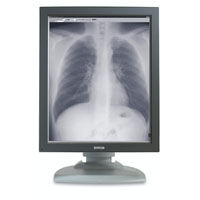 5MP Diagnostic Display Monitor — Barco MFGD5421