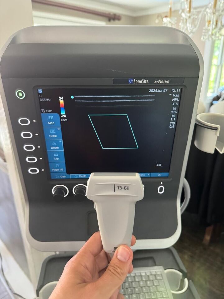 Sonosite S-Nerve Ultrasound System with Cart and L38x Vascular Probe