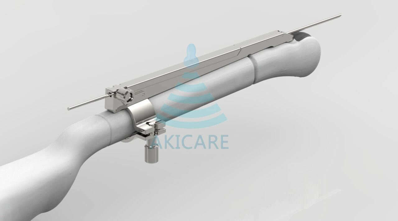 Esaote EC123/EC1123 Ultrasound Probe Biopsy Guide Kit