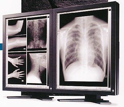 Radiology Display Monitor for Diagnostic Imaging — Eizo RadiForce FC-2091 (OFT02947SQ)