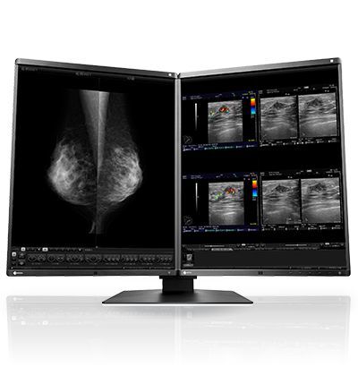 Diagnostic Display Monitor by EIZO (RX560)