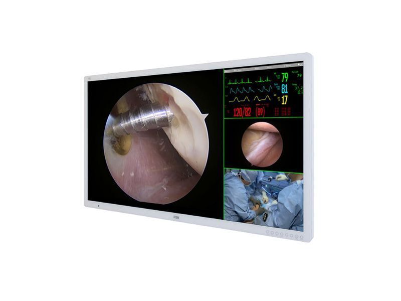 55-inch 4K Surgical Monitor from Foreseeson — FM-A5504DS