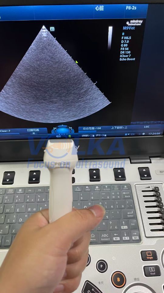 Mindray P8-2s Sector Array Ultrasound Transducer