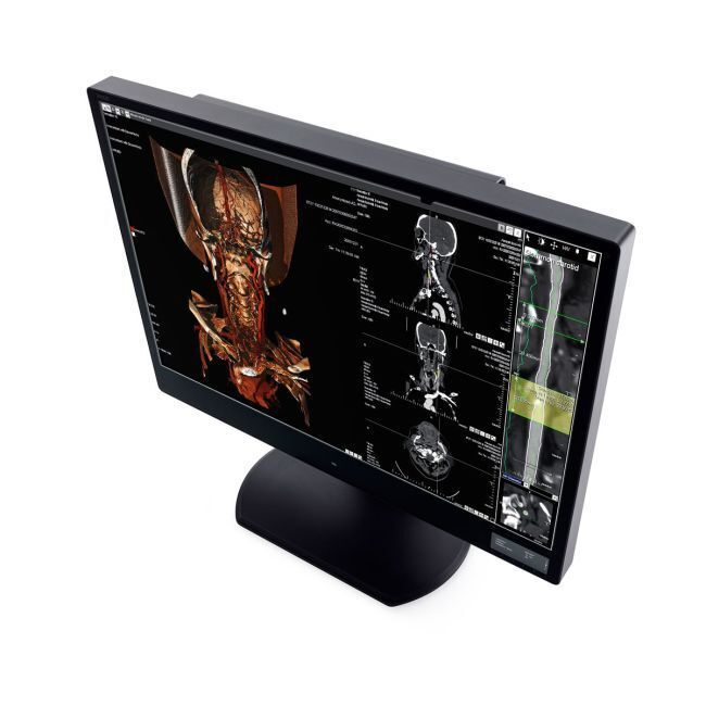 6MP Diagnostic Radiology Display Monitor — WIDE CW60N