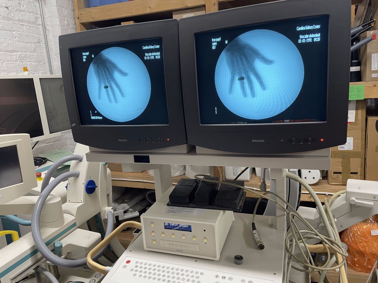 Philips BV Pulsera Digital Mobile C-Arm System