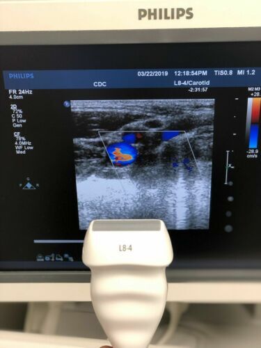 Philips L8-4 Linear Ultrasound Transducer Probe