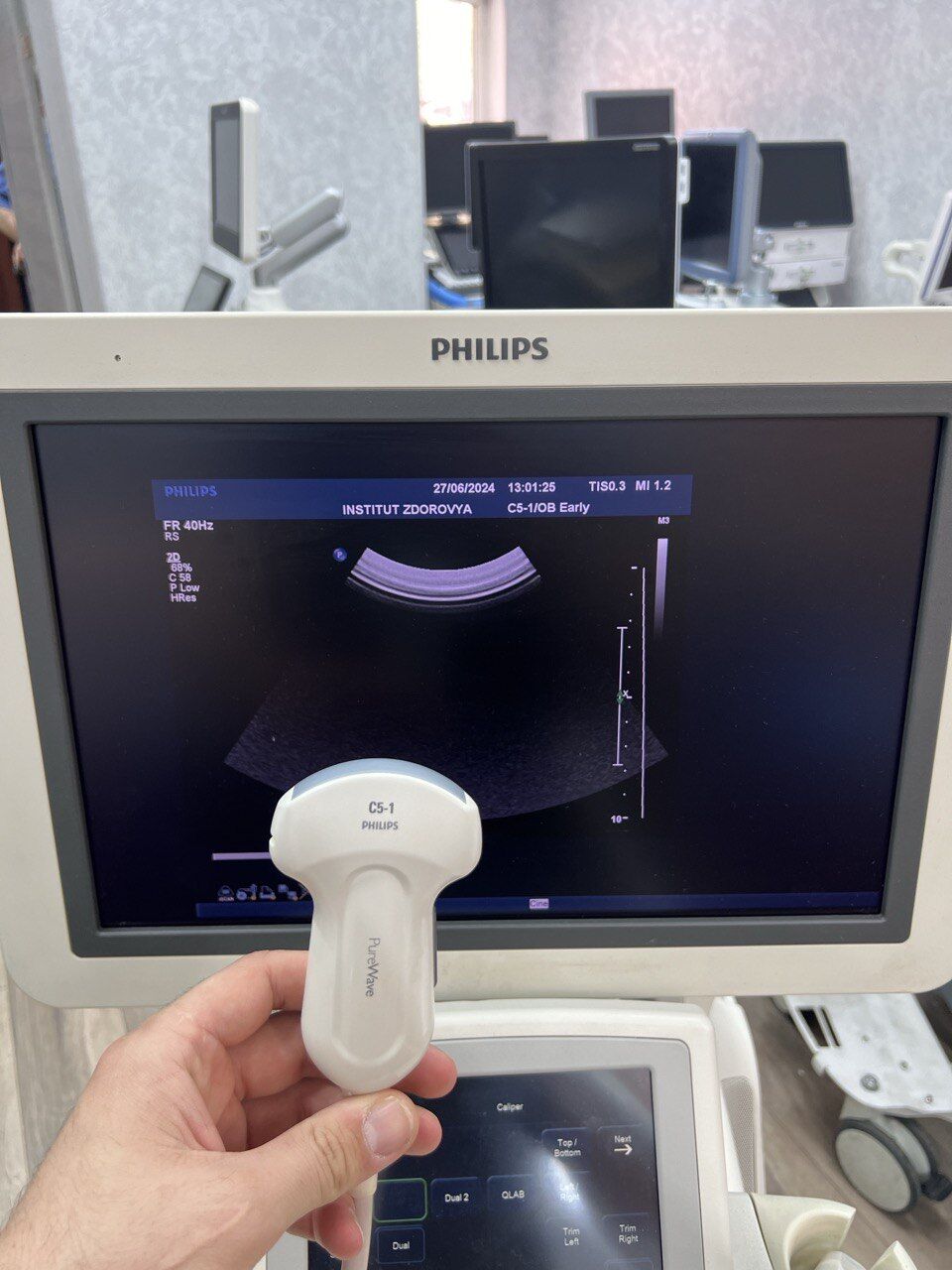 Philips iU22 Ultrasound System