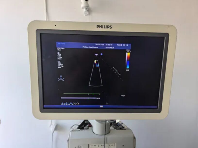 Philips UTAP20W 20-Inch Medical LCD Display Monitor