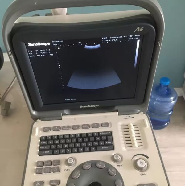 SonoScape A5 Portable B/W Ultrasound Scanner