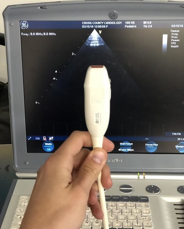 GE 10S-RS Sector Array Ultrasound Transducer
