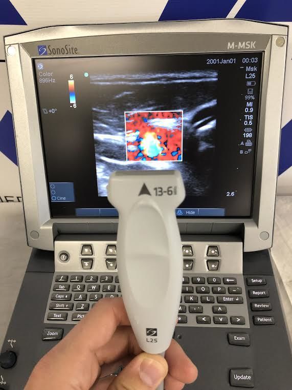 SonoSite M-Turbo Portable Digital Ultrasound System