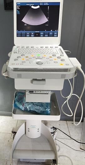 Philips CX30 Portable Ultrasound System