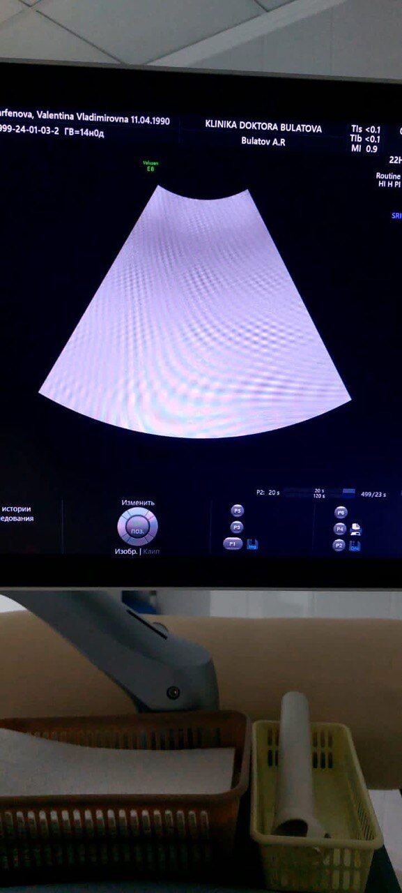 GE Healthcare Voluson E8 BT21 Ultrasound System Repair Service