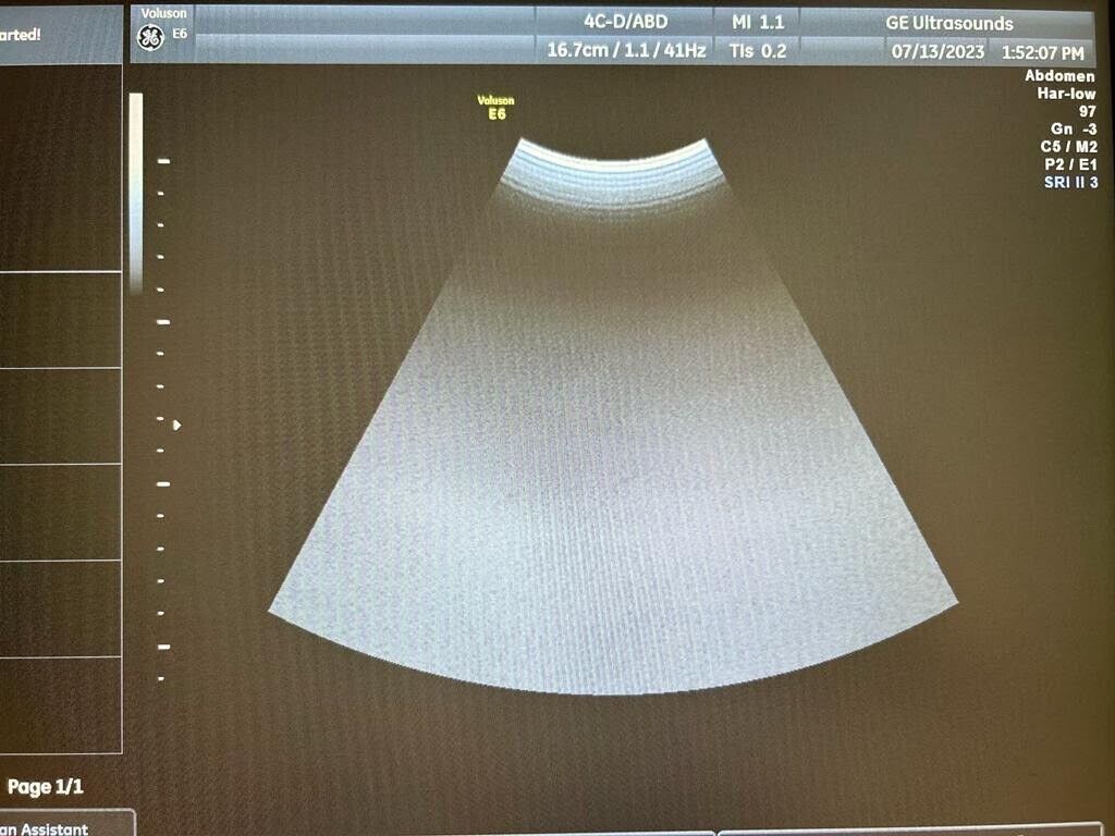GE 4C-D Convex Ultrasound Transducer for Abdominal & OB/GYN Imaging