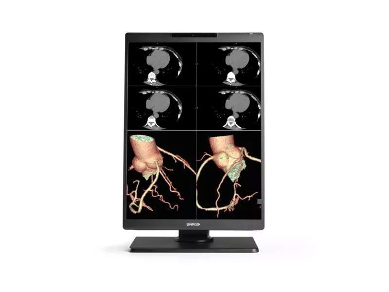 Barco Nio MDNC-3521 3MP Diagnostic Radiology Monitor