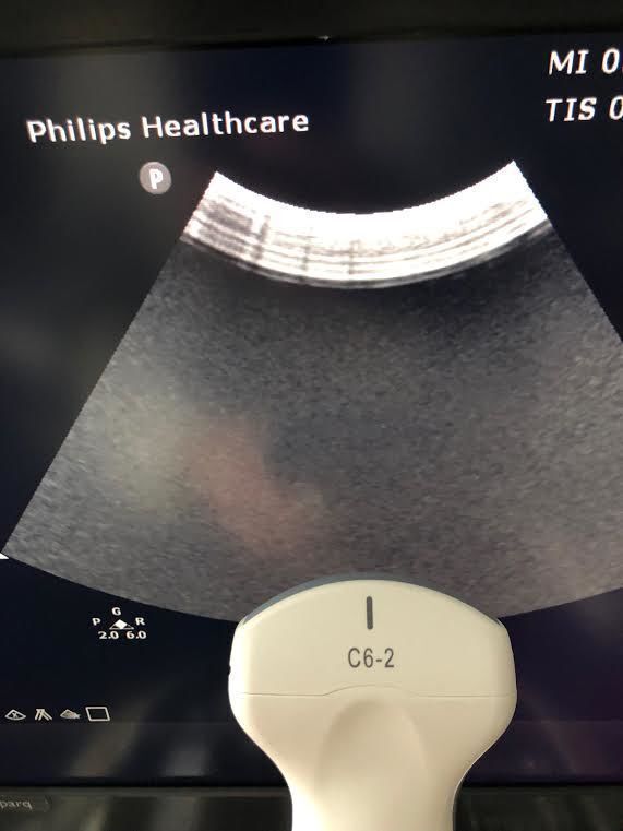 Philips C6-2 Curved Array Ultrasound Transducer