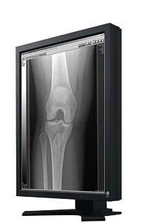 EIZO 2MP RadiForce G22 Diagnostic Display Monitor