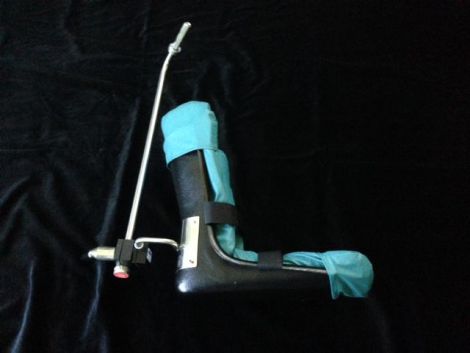 Adjustable Allen A-10001-F Single Surgical Stirrup