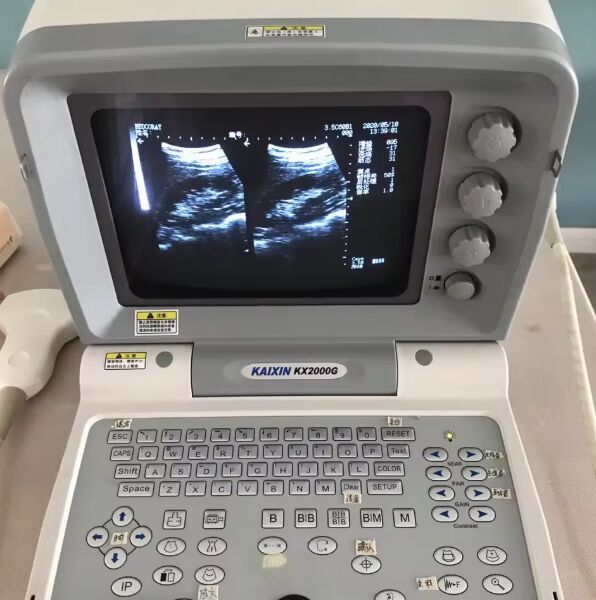 Kretz Kaixin KX2000g Ultrasound System with Convex Probe