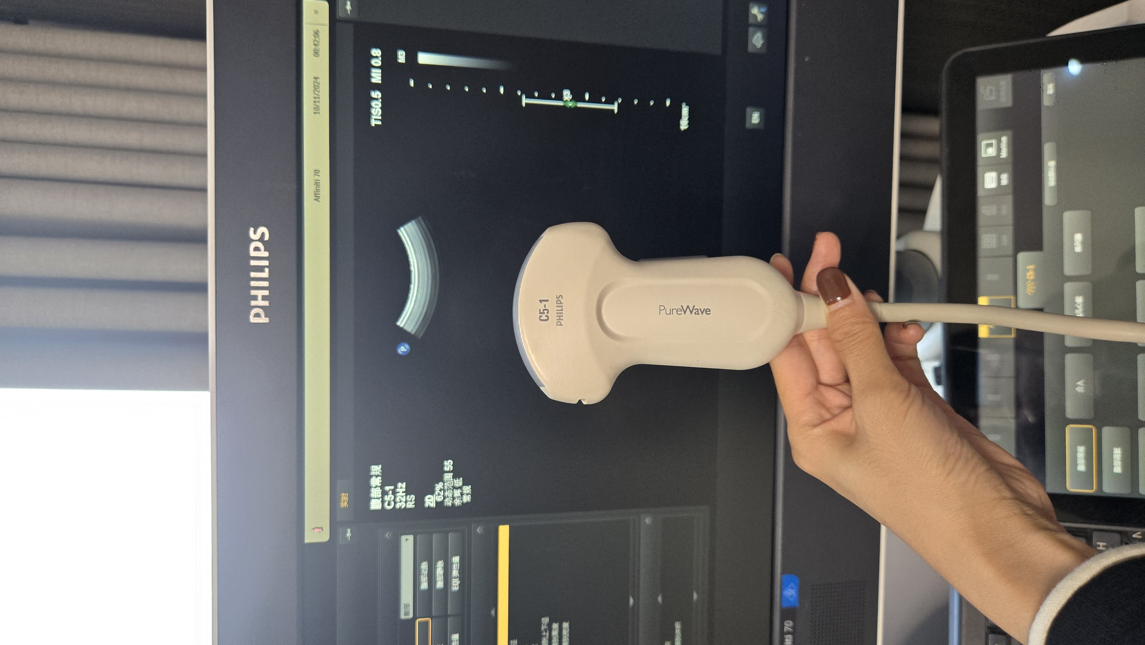 Philips Compact C5-1 PureWave Convex Ultrasound Probe for CX50 and Sparq Systems – Abdominal, OB/GYN and General Imaging