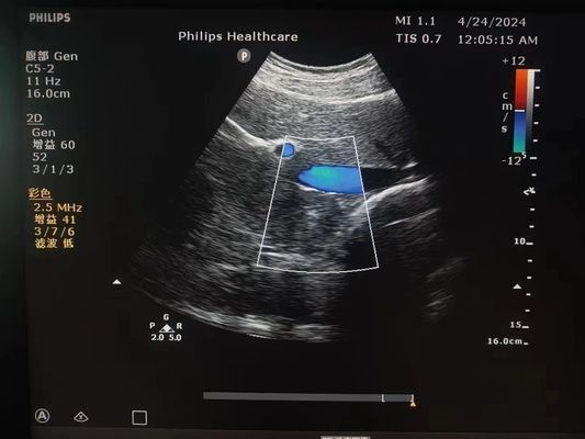 Philips C5-2 Convex Array Ultrasound Probe