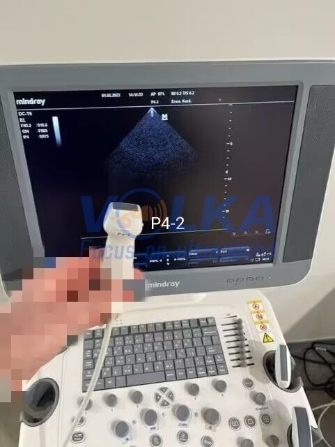 Mindray P4-2 Phased Array Ultrasound Transducer