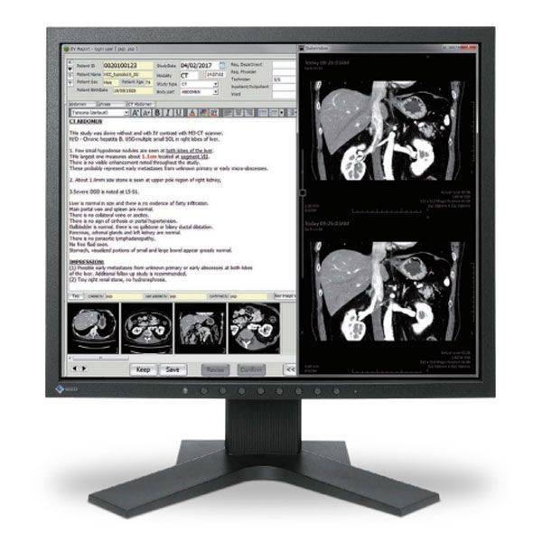 RadiForce MX194-BK Diagnostic Display Monitor from EIZO