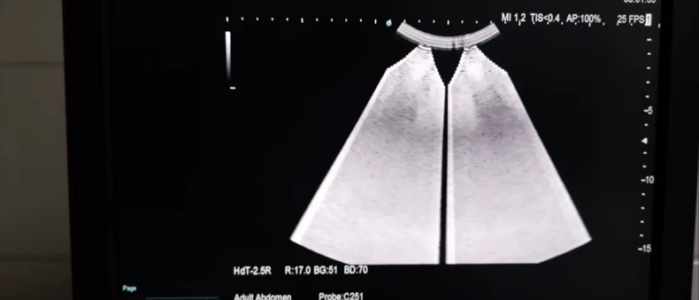 Hitachi ARIETTA 60 RDBF Board Repair Service (EP576200 – Image Noise / Artifact / Abnormal Imaging)