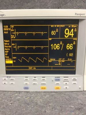 Datascope Passport XG Multiparameter Patient Monitor