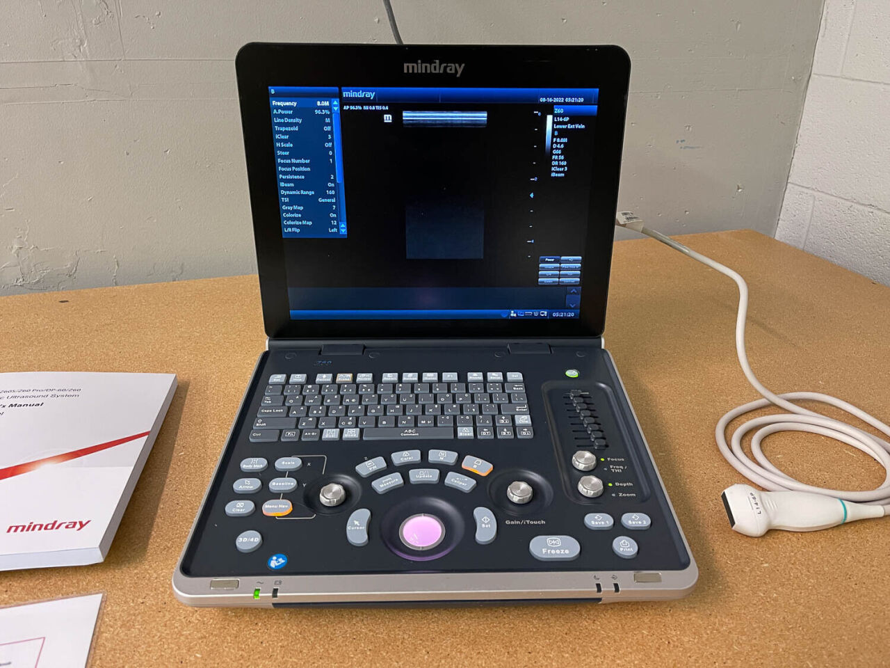 Mindray Z60 Ultrasound System for MSK and General Use